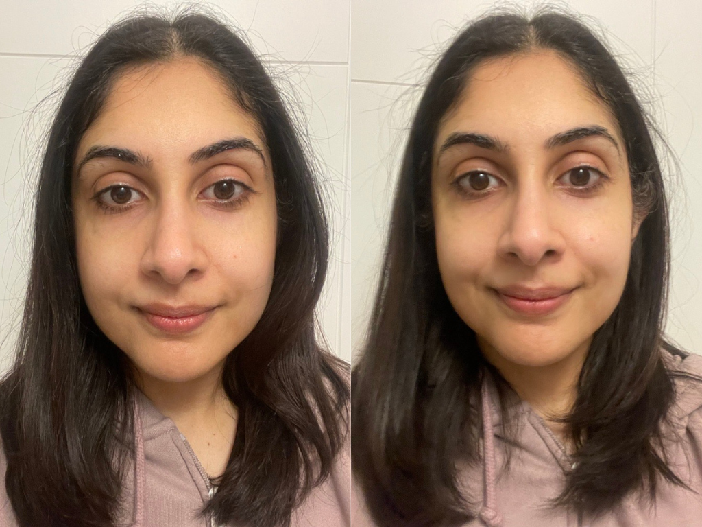 Before and after using Dr Dennis Gross peel pads | Space NK